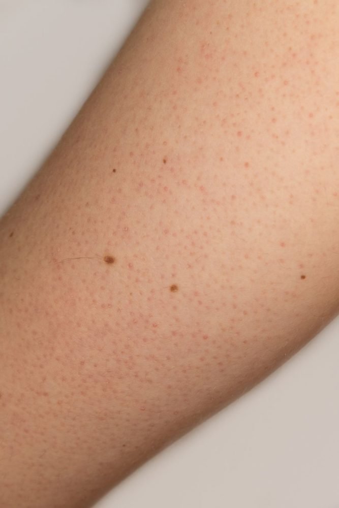 8 распространенных проблем с кожей и способы их решения